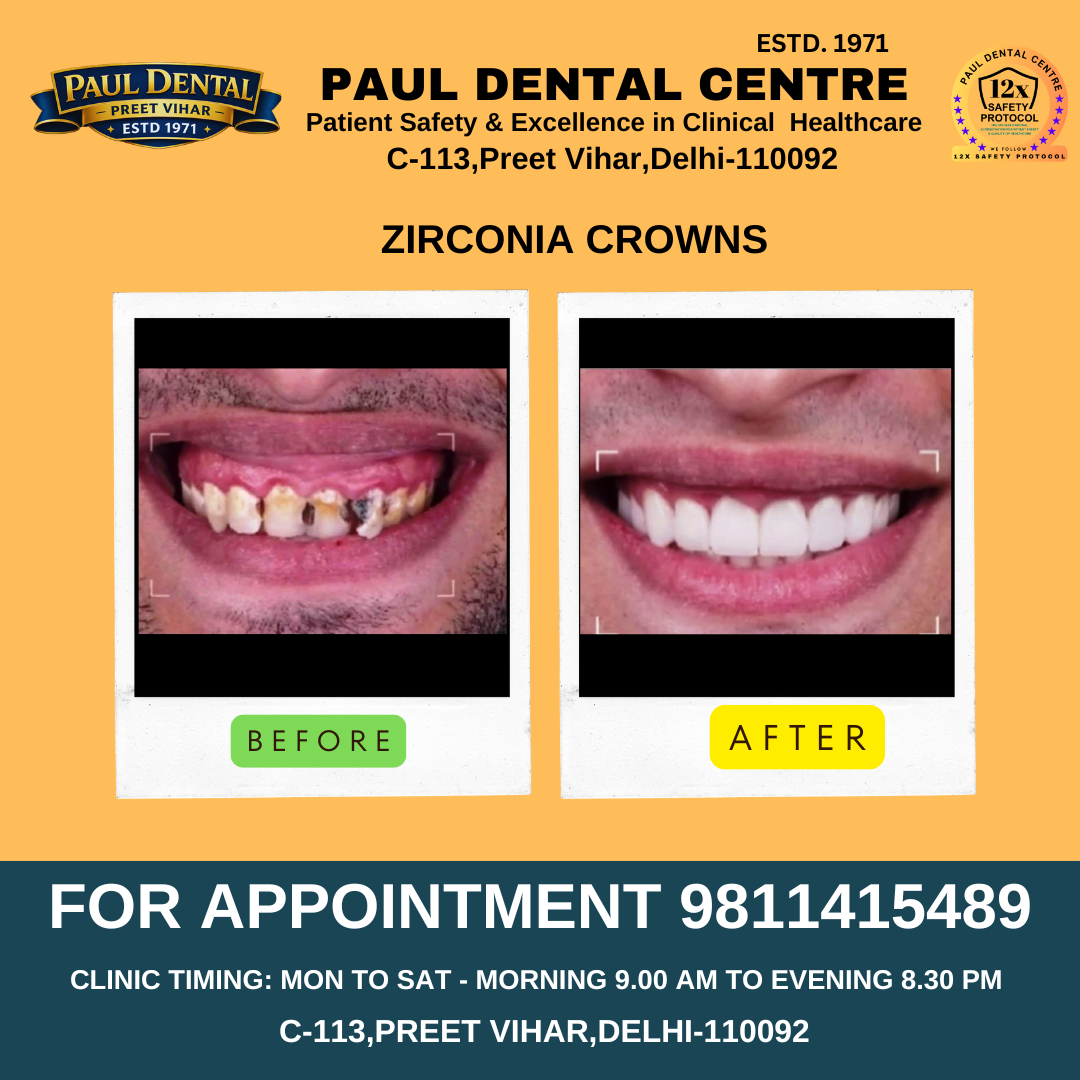 Case 34 – Paul Dental Center